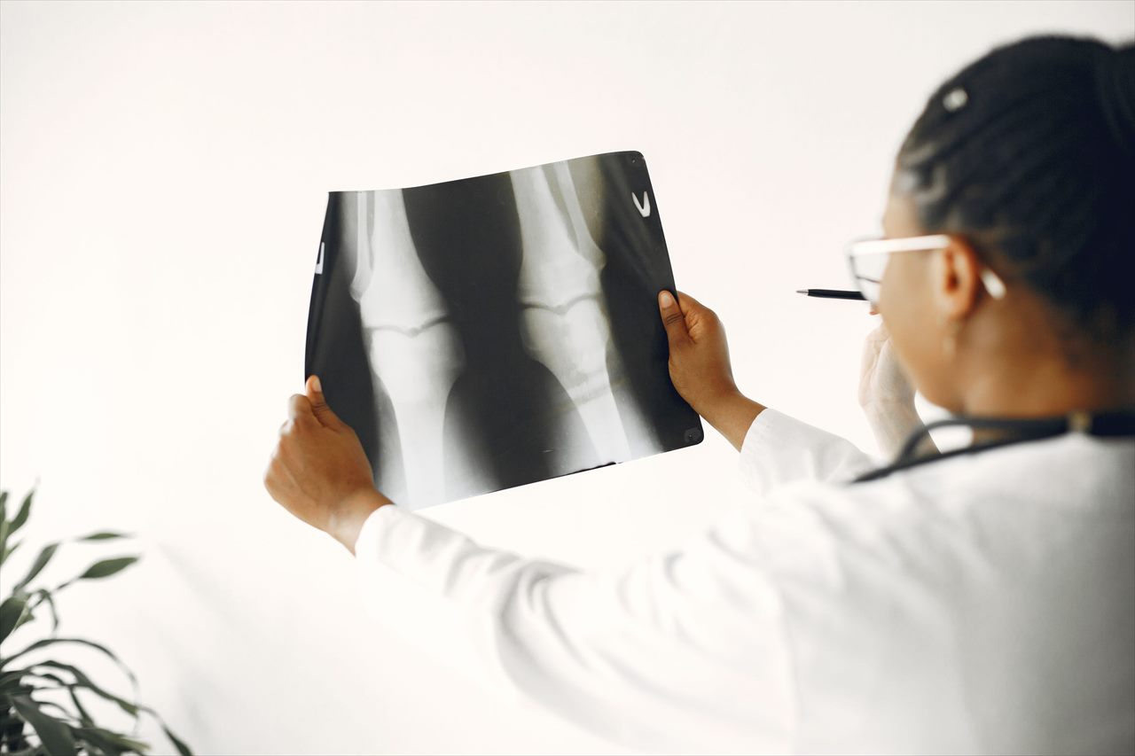 Médico analisando a radiografia de um joelho